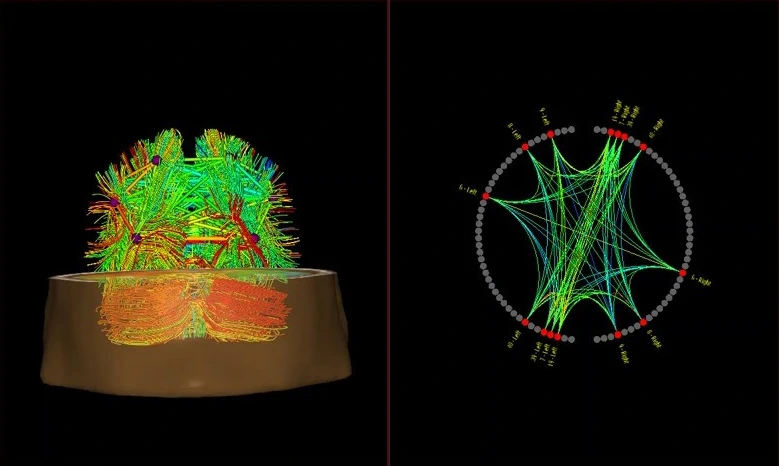 Fibre nodes
