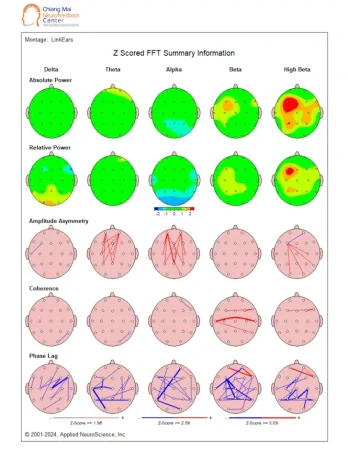 Z-Scores Surface Brain map